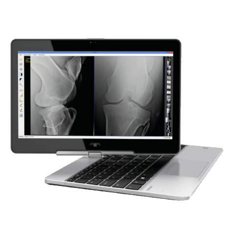 HP_Revolte_80_mit_Bild